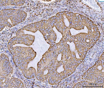 ECHS1 Antibody