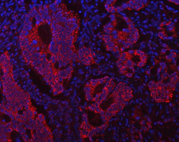 ECHS1 Antibody