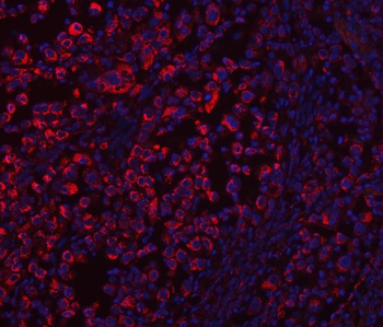 ECHS1 Antibody