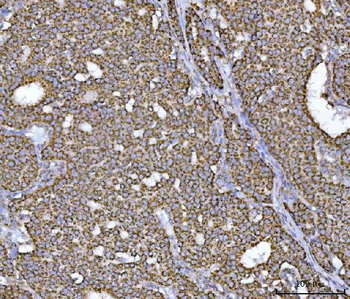 ECHS1 Antibody