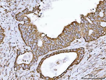 ECHS1 Antibody