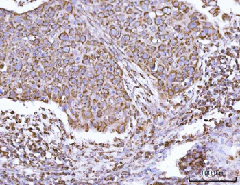 ECHS1 Antibody