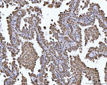 ECHS1 Antibody