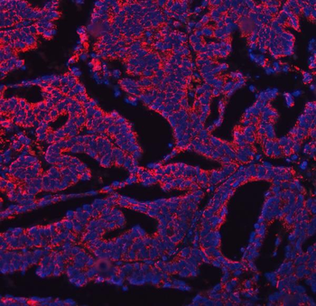 COX5B Antibody