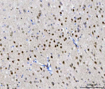 CHD1 Rabbit Polyclonal Antibody