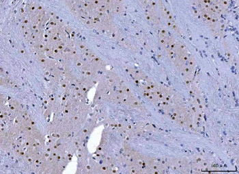 CHD1 Rabbit Polyclonal Antibody
