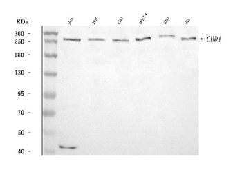 CHD1 Rabbit Polyclonal Antibody