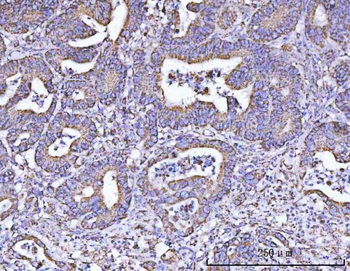ATP5F1B Antibody