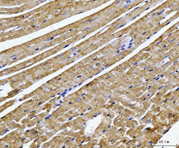 ATP5F1B Antibody