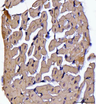 ATP5F1B Antibody