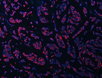 ATP5F1B Antibody