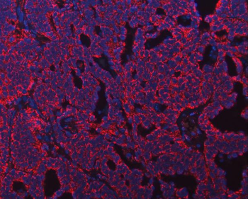 ATP5F1B Antibody