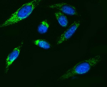 ATP5F1B Antibody