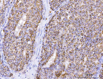 ATP5F1B Antibody