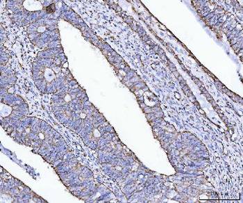 ATP5F1B Antibody