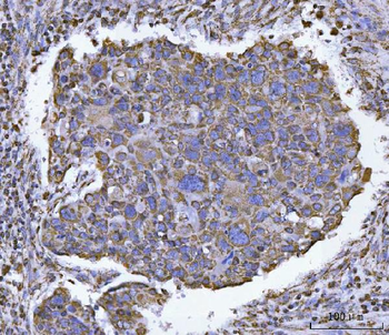 ATP5F1B Antibody