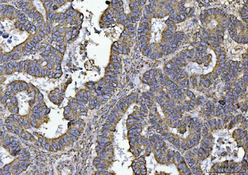 ATP5F1B Antibody