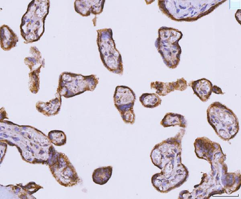 ATP5F1B Antibody