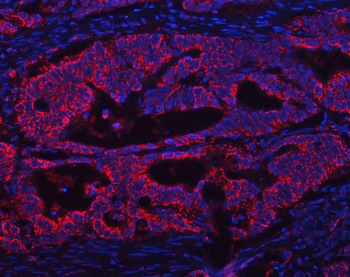 ATP5F1A Antibody