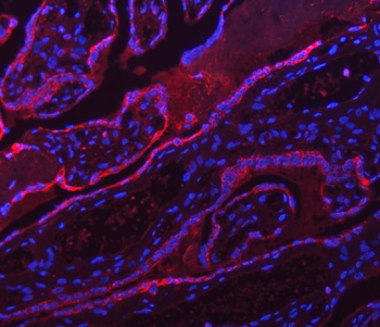 ATP5F1A Antibody