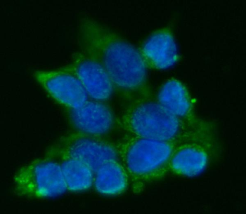 ATP5F1A Antibody