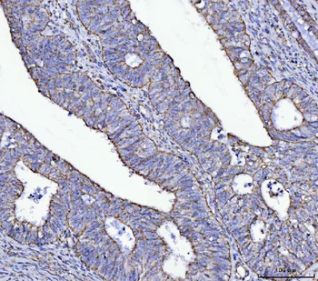 ATP5F1A Antibody