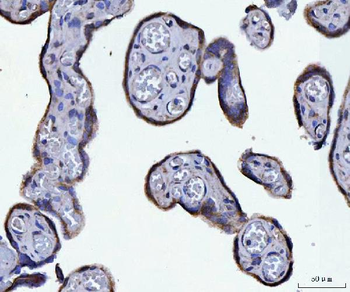 ATP5F1A Antibody