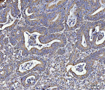 ATP5F1A Antibody