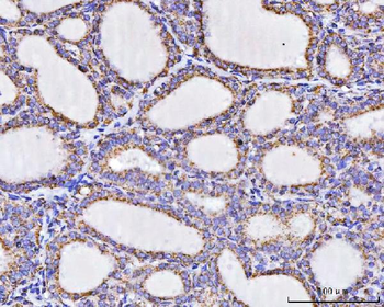 ATP5F1A Antibody