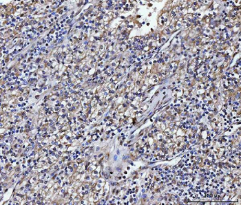 ATP1B2 Rabbit Polyclonal Antibody