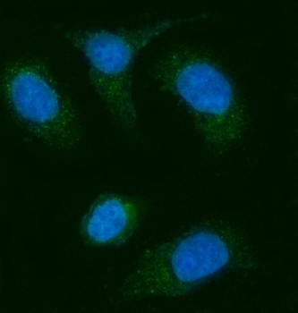 AGPS Antibody