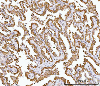 AGPS Antibody