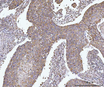 AGPS Antibody