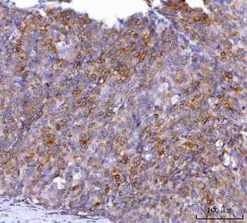 AGPS Antibody