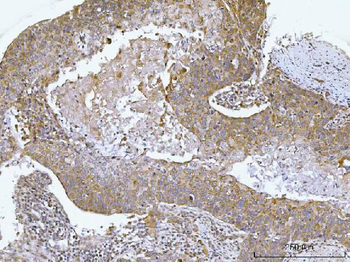 AGPS Antibody