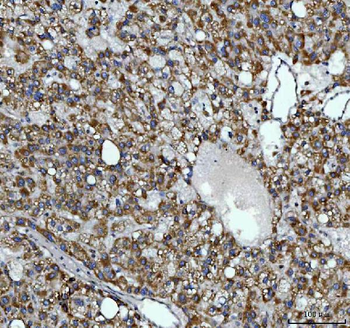 AGPS Antibody