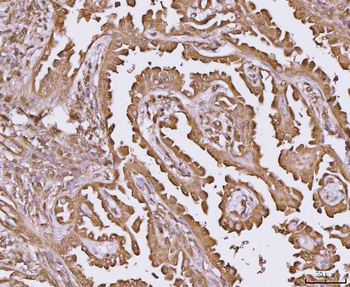 YWHAE Rabbit Polyclonal Antibody