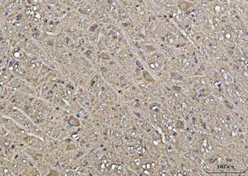YWHAE Rabbit Polyclonal Antibody