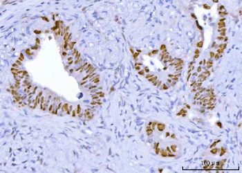 TP53 Rabbit Polyclonal Antibody