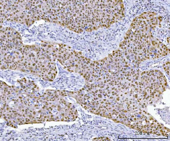 TP53 Rabbit Polyclonal Antibody