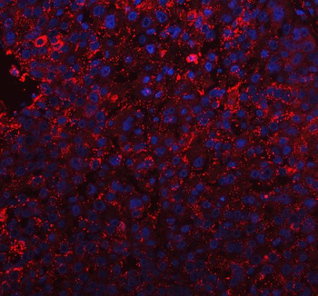 BI-1/TMBIM6/BI Rabbit Polyclonal Antibody
