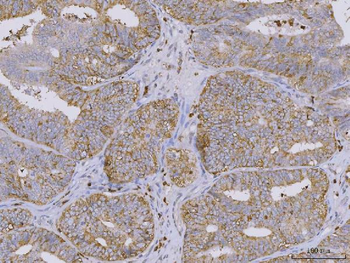 BI-1/TMBIM6/BI Rabbit Polyclonal Antibody