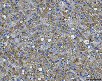 BI-1/TMBIM6/BI Rabbit Polyclonal Antibody