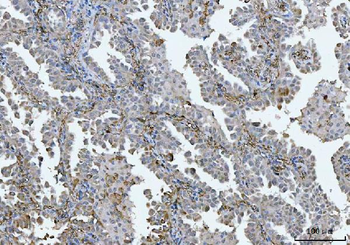 BI-1/TMBIM6/BI Rabbit Polyclonal Antibody
