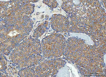 RPL32 Antibody