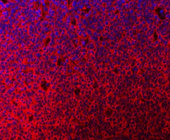 MTHFD1 Antibody
