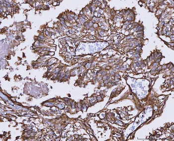 MTHFD1 Antibody
