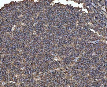 MTHFD1 Antibody