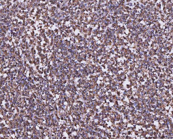 MTHFD1 Antibody
