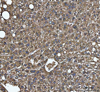 MTHFD1 Antibody